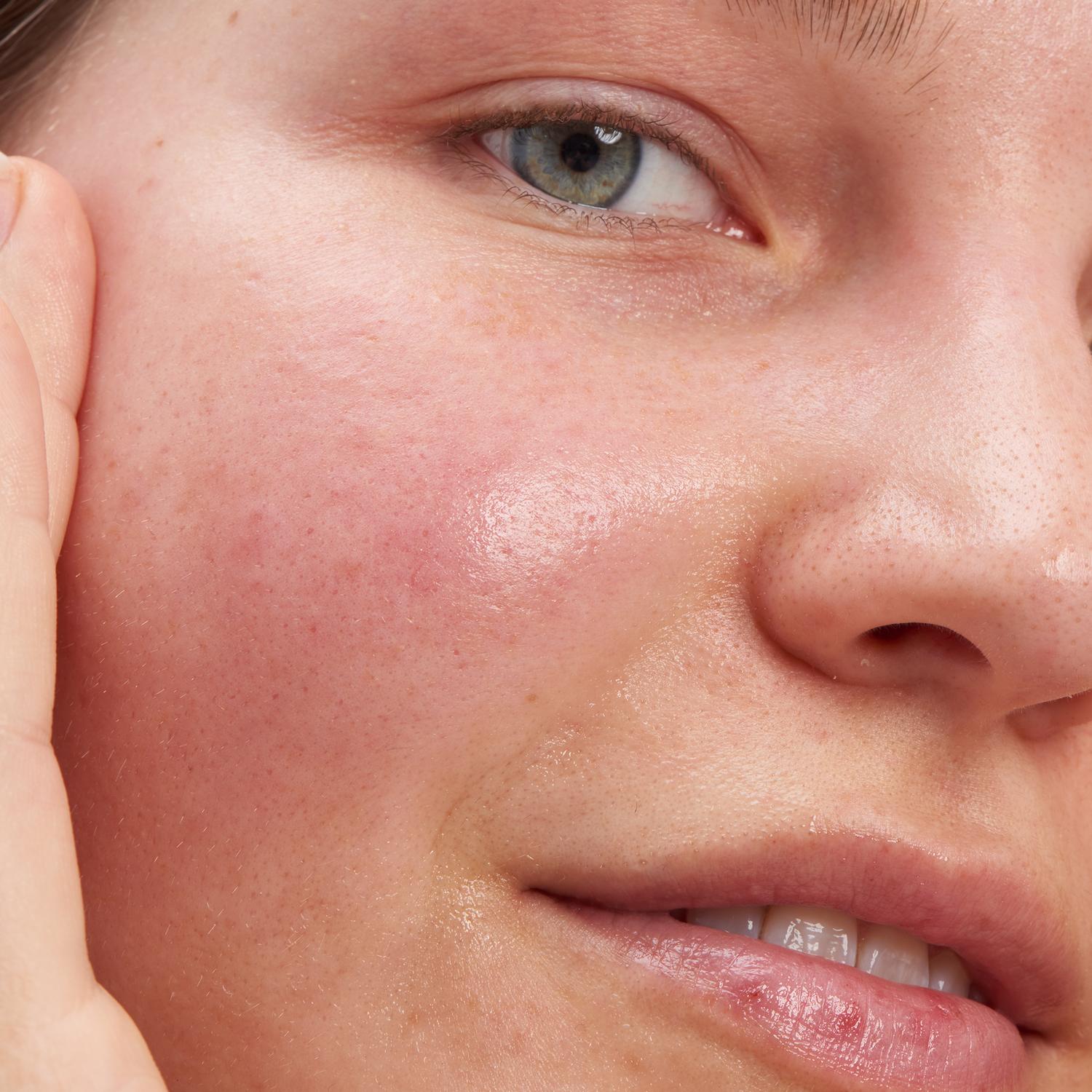 GLYCOLIC ACID EXFOLIATING TONER (T&Oacute;NICO EXFOLIANTE)